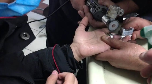 İTFAİYEDEN YÜZÜK OPERASYONU