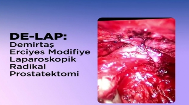 ERÜ'DEN YERLİ TEDAVİ DE-LAP