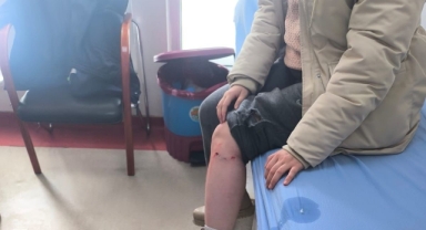 SOKAK KÖPEĞİNİN SALDIRISINA UĞRAYAN ÇOCUK YARALANDI